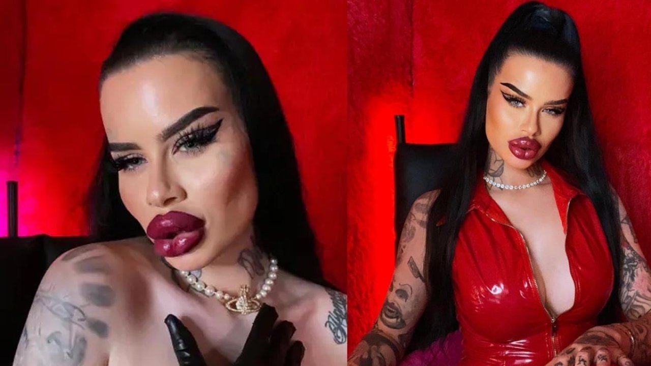 Estetik Bağımlılığı Çığırından Çıktı! 2 Milyon TL Harcadı, Yüzü Tanınmaz Halde 5 494235