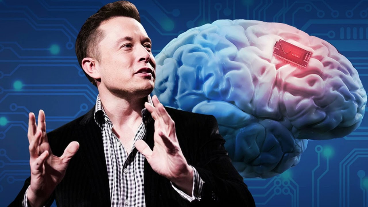 Elon Musk bir kişiye daha çip taktı! 4 Elon Musk Neuralink