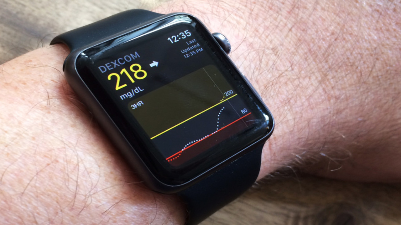 Yeni Apple Watch'lar sağlık tarafında fark yaratacak 9 apple watch saglik ozelliklerinin guvenilirligi arastirildi